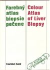 Tomík František - Farebný atlas biopsie pečene